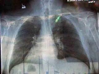 Jesus_x-ray